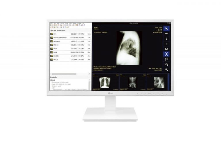 LG Monitor 24CK560N-3A Thin Client All-in-One 60,5 cm (23.8")